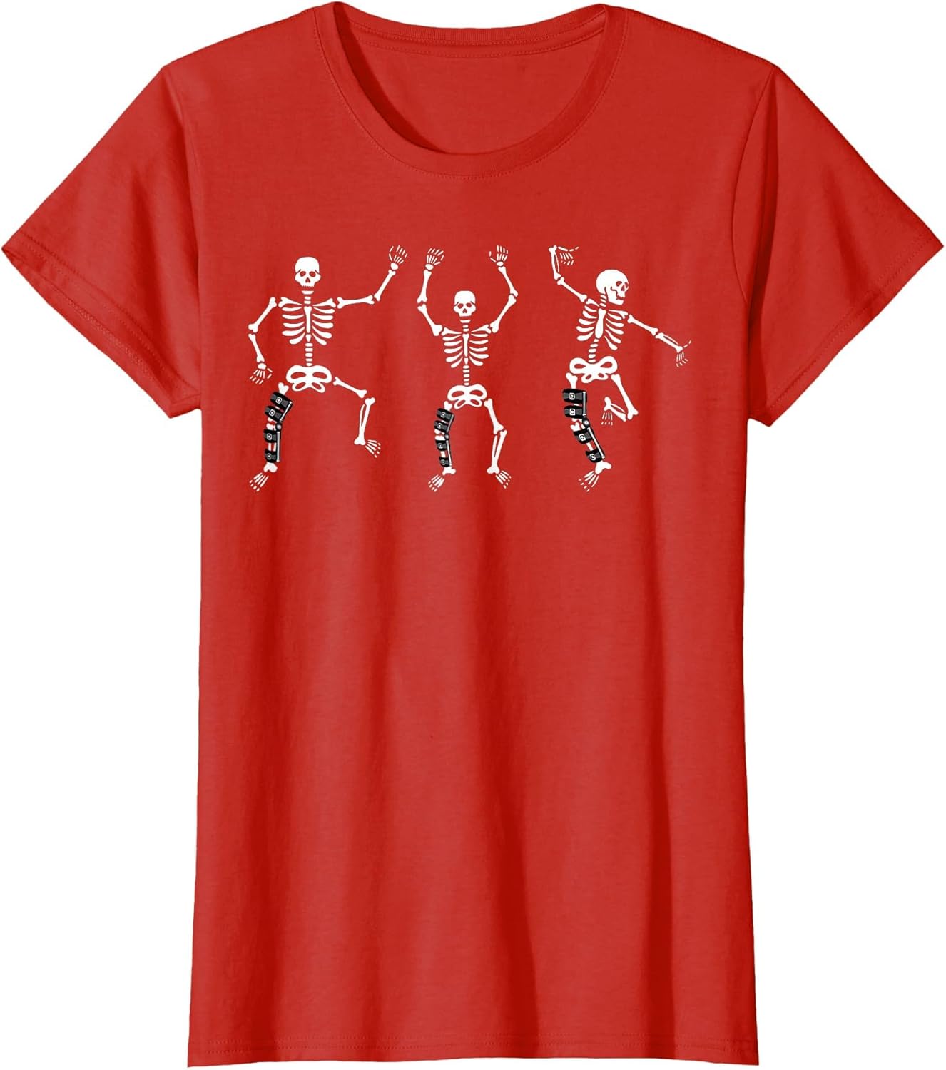 Knee Surgery Brace Skeletons Dancing ACL Surgery