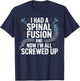 Funny Spinal Fusion Back Surgery Recovery Humor Gifts Women T-Shirt - T-Shirt | Navy
